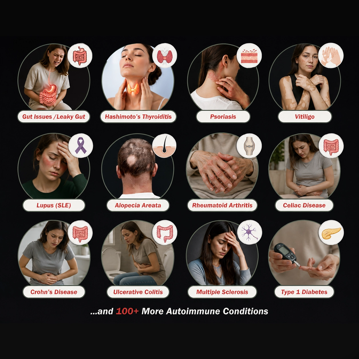 Autoimmune